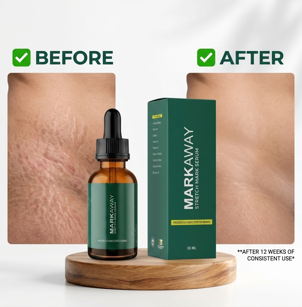 Markaway Herbal Stretch Mark Serum (30ml)